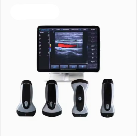 handheld medical medical wifi wireless Clear Imaging in Healthcare Ultrasound Machine